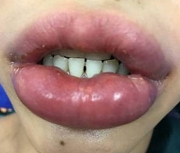 tham my vien hoang tuan bi phat vi quang cao nang nguc trai phep