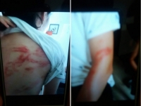 hoi bao ve quyen tre em len tieng vu bo de bao hanh 2 con tai ha noi