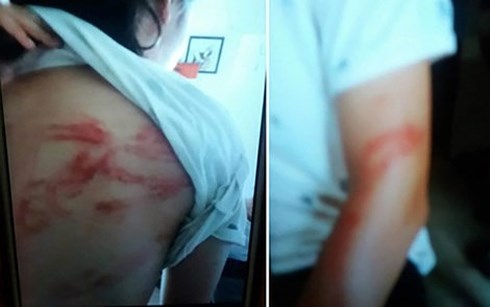 hoi bao ve quyen tre em len tieng vu bo de bao hanh 2 con tai ha noi