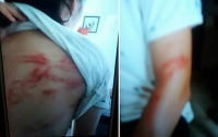 vu bo bi to cao bao hanh con de toi co dung gay nhom danh con