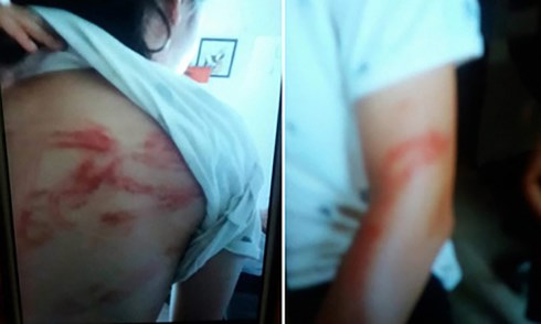 vu bo bi to cao bao hanh con de toi co dung gay nhom danh con