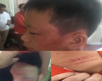 be 4 tuoi o trung quoc bi cha danh tham tim mat ep giat quan ao