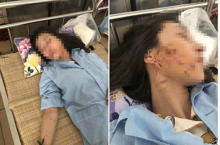 vu danh ghen lot do do mam ot o thanh hoa va cai ket khong bat ngo