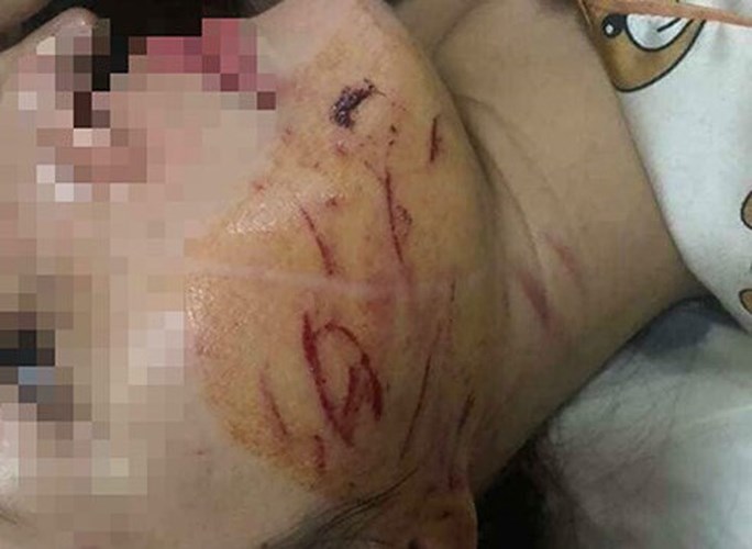 vu danh ghen lot do do mam ot o thanh hoa va cai ket khong bat ngo