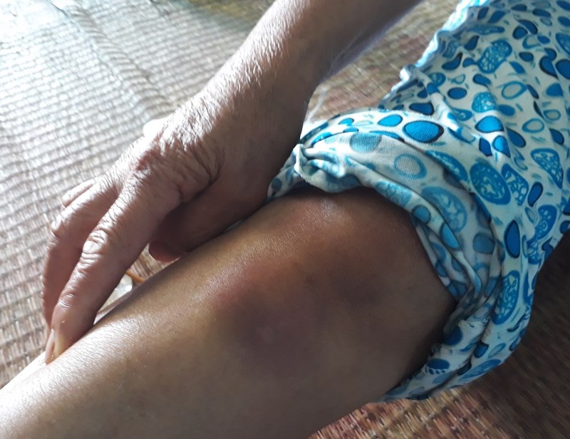 2 phu nu bi danh vi nghi bat coc ho qua hung han