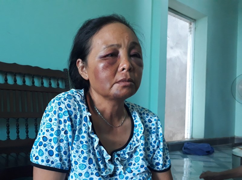 2 phu nu bi danh vi nghi bat coc ho qua hung han