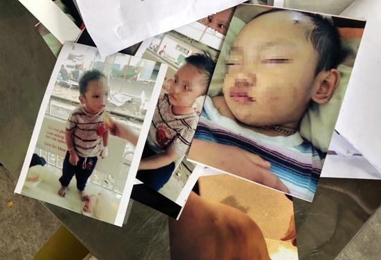 giam doc cong an binh duong chi dao dieu tra vu me to con gai hanh ha chau ngoai