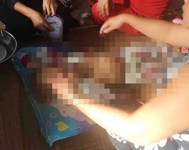 khoi to ke danh be gai 4 tuoi den chet o vinh long