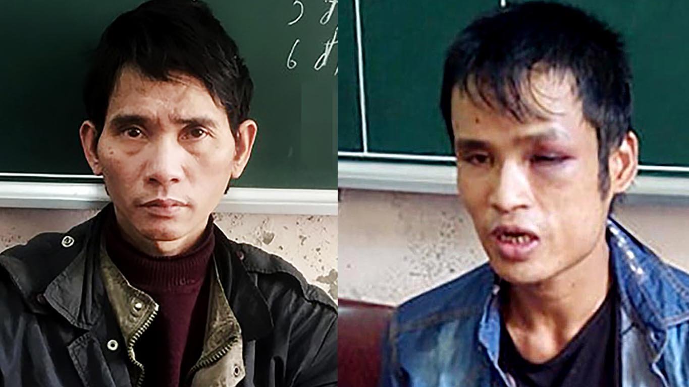 bong hong bi an khien 2 trum ma tuy khet tieng sa luoi