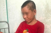 tinh gia lai hoa toc yeu cau xu ly vu co gai bi tra tan da man