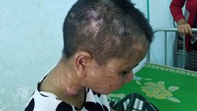 Cuộc trốn chạy giữa đêm mưa của thiếu nữ 'tố' bị chủ nhà dùng bàn là ủi mặt, kìm bẻ răng và cắt tai