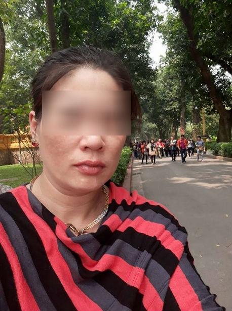 thieu nu chu nha dung ban la ui mat kim be rang va cat tai chu nha cho rang minh bi thep gai manh thuy tinh vao dau
