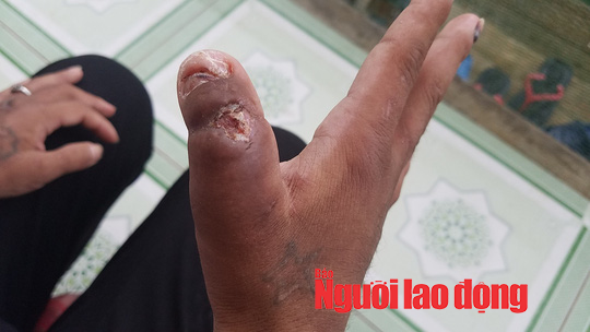 vu nga voc tra tan da man y nhieu khai gi voi cong an