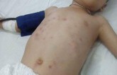 Bắt nghi phạm đánh đập con riêng của người tình nhập viện