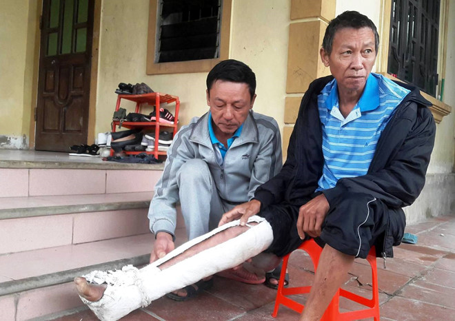 loi khai cua nghich tu danh bo gay xuong suon