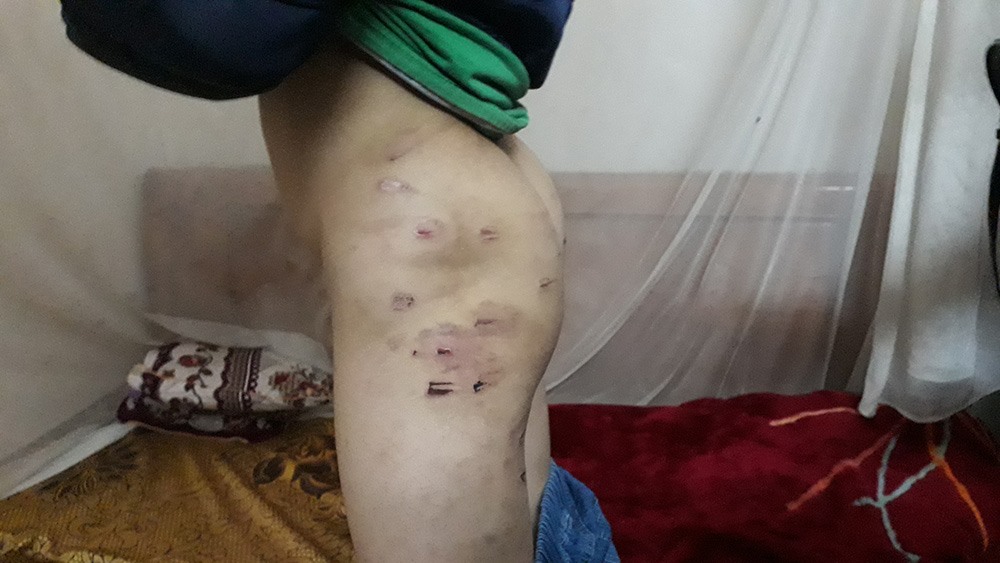 vu be 9 tuoi bi bo bao hanh cong an xa noi phai danh cho chau ngoan