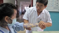 bien chung nguy hiem tu benh thuy dau