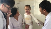 ha noi nam nhan vien rua xe lui oto bat can khien 5 nguoi trong thuong