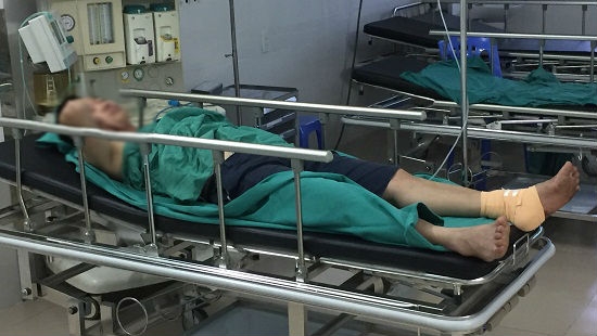 hai duong dieu tra nhom con do hanh hung cat gan chan phu xe khach