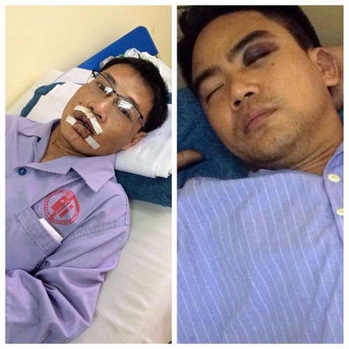 cong an vao cuoc vu khach danh vo mat nhan vien petrolimex vi nghi gian doi