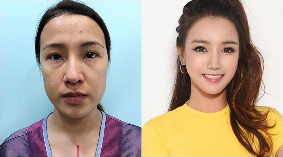 co gai sai gon phau thuat guong mat khien bo me khong nhan ra con