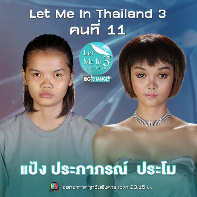 khong qua xau xi co gai 20 tuoi van quyet phau thuat tham my va cai ket gay tranh cai