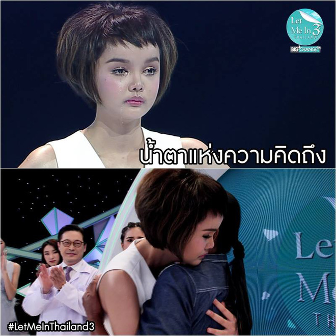 khong qua xau xi co gai 20 tuoi van quyet phau thuat tham my va cai ket gay tranh cai