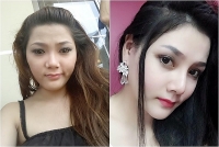 lan dan tinh duyen co gai 9x chiu 4 lan phau thuat dau don de co guong mat xinh nhu dien vien
