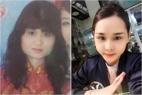 chang bac si san khoa chi mot ty dong phau thuat tham my