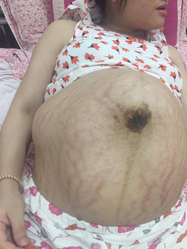 hinh anh bung bau nhu sap roi khien chi em chang con muon de doi mot lan cho xong