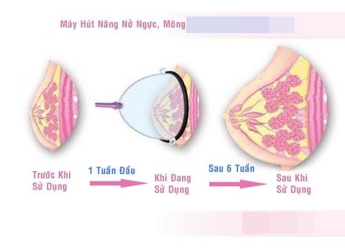 tam chuyen dao keo nang nguc bang may hut khong mo xe hieu qua tuc thi