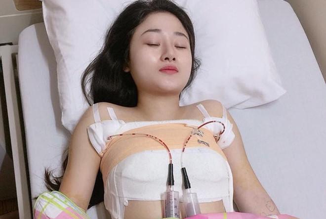 tam chuyen dao keo nang nguc bang may hut khong mo xe hieu qua tuc thi
