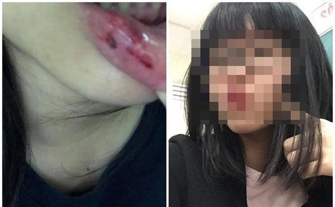 vu anh re bi to bao hanh em vo viec nha chua to ngoai ngo da thong