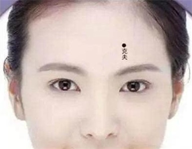 5 not ruoi khac chong khong the khong xoa bo