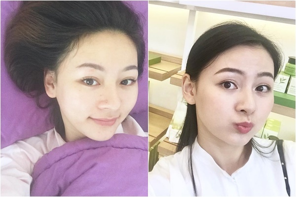 chu trinh duong da tu da thien dau thanh da thuong cua bb banh beo phu phiem