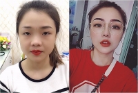 khong dep la mot thiet thoi 9x phau thuat tham mi de hoan hao nhu bup be