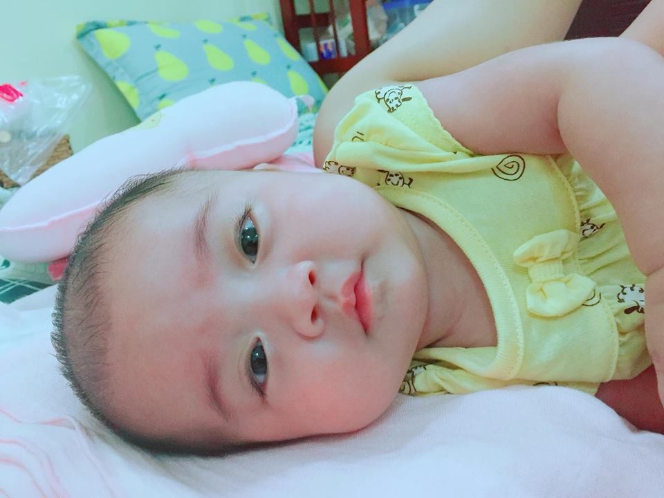 2 thang duoc me ap lien tuc em be sinh non 27 tuan nang 1 kg hoi sinh ki dieu
