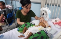 bi hoai tu chan do khong tuan thu lich uong thuoc tim mach