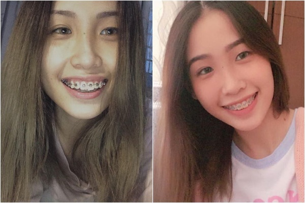 co nang rang ho thanh hot girl nieng rang nho nu cuoi rang ro