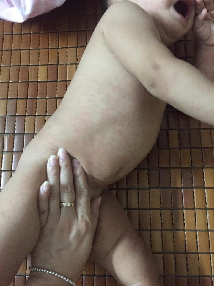 nhat ki cung con tri benh kawasaki cua ba me ha noi