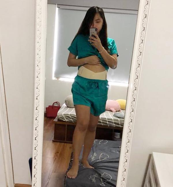 Vừa tháo chỉ sau đẻ mổ 5 ngày, Hải Băng được bác sĩ dặn: 'Em cuốn đai vào bụng nhé!' vua thao chi sau de mo 5 ngay hai bang duoc bac si dan em cuon dai vao bung nhe