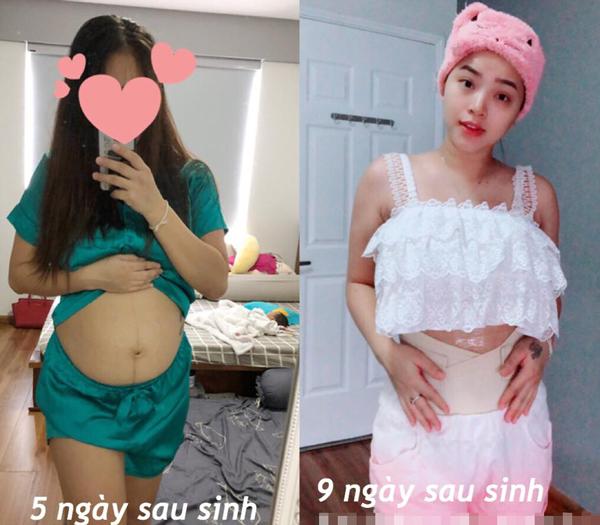Vừa tháo chỉ sau đẻ mổ 5 ngày, Hải Băng được bác sĩ dặn: 'Em cuốn đai vào bụng nhé!' vua thao chi sau de mo 5 ngay hai bang duoc bac si dan em cuon dai vao bung nhe