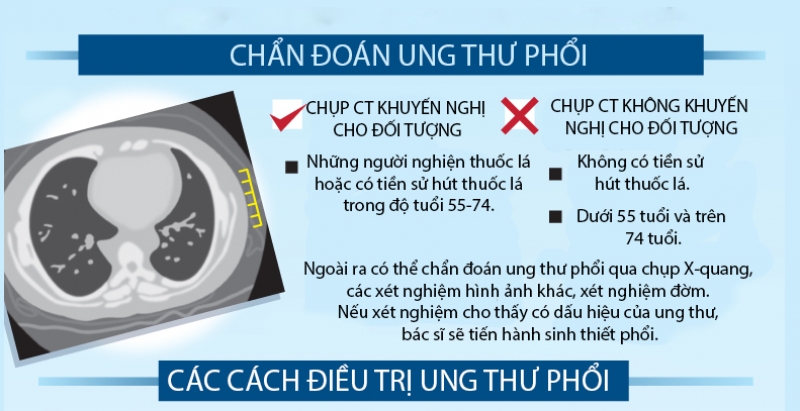 ung thu phoi nguy hiem den muc nao