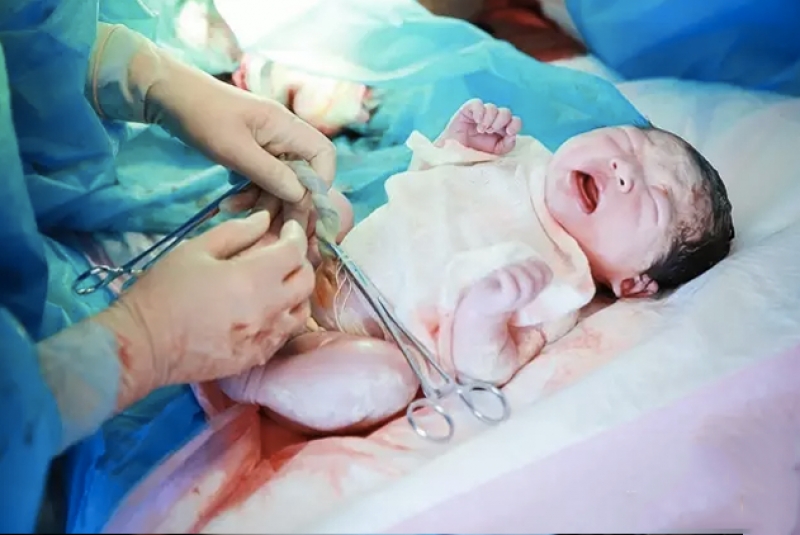 Xúc động trước bộ ảnh ‘nhật ký đi đẻ’ chân thực của bà mẹ trẻ xuc dong truoc bo anh nhat ky di de chan thuc cua ba me tre