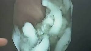 day la nhung gi xay ra trong da day sau khi ban an mi tom