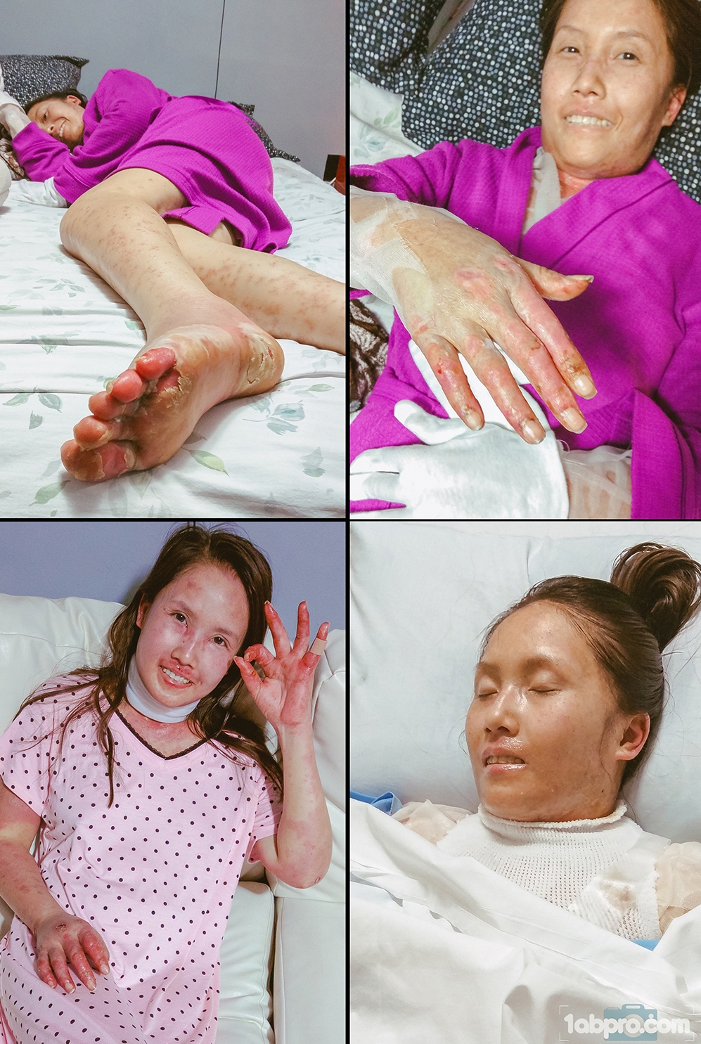 Hành trình mang thai đầy đau đớn của mẹ từ chối điều trị bệnh, giữ mạng sống cho con hanh trinh mang thai day dau don cua me tu choi dieu tri benh giu mang song cho con