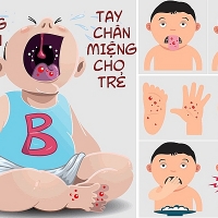 8 dau hieu tu ray tai danh gia suc khoe cua ban