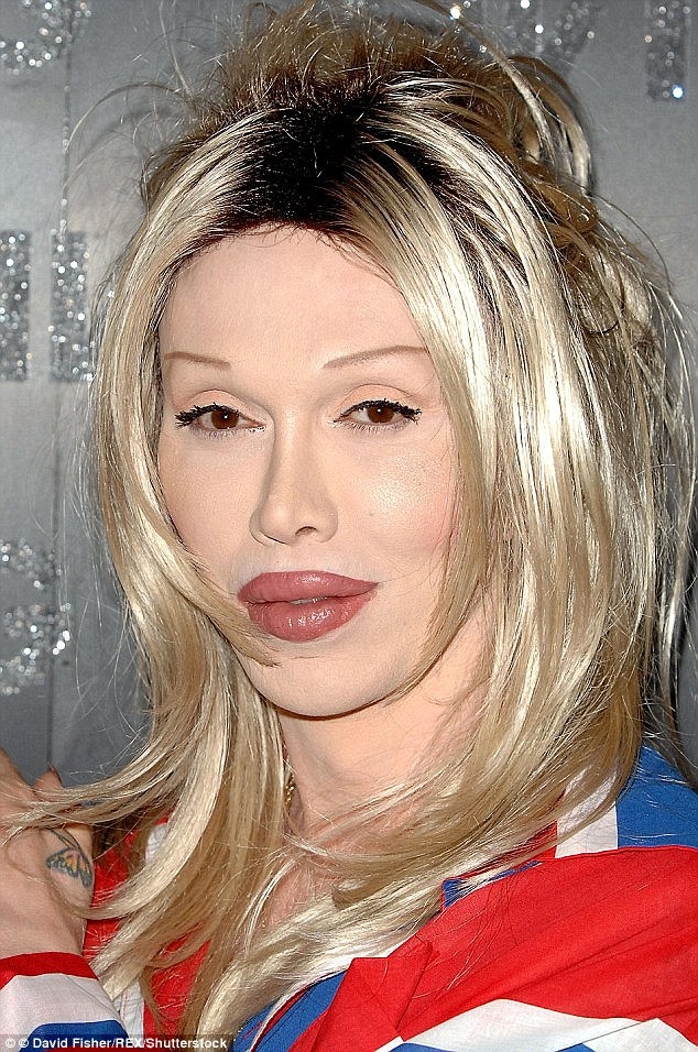 pete burns nam ca si tung 300 lan dao keo qua doi o tuoi 57