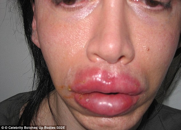 pete burns nam ca si tung 300 lan dao keo qua doi o tuoi 57