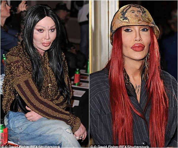 pete burns nam ca si tung 300 lan dao keo qua doi o tuoi 57